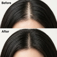 The Korean Scalp Revival Bar 3